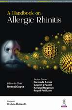 A Handbook on Allergic Rhinitis