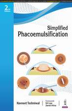 Simplified Phacoemulsification