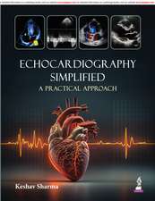 Echocardiography Simplified: A Practical Approach