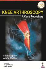 Knee Arthroscopy