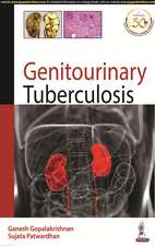 Genitourinary Tuberculosis