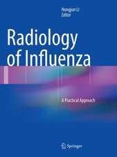 Radiology of Influenza: A Practical Approach