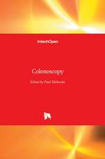 Colonoscopy