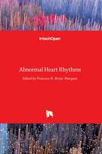 Abnormal Heart Rhythms