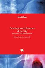 Developmental Diseases of the Hip