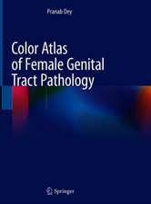 Color Atlas of Female Genital Tract Pathology