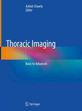 Thoracic Imaging: Basic to Advanced