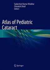 Atlas of Pediatric Cataract