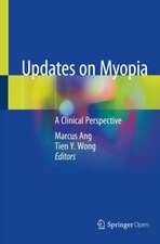 Updates on Myopia: A Clinical Perspective