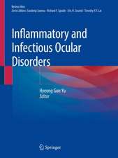 Inflammatory and Infectious Ocular Disorders