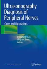 Ultrasonography Diagnosis of Peripheral Nerves: Cases and Illustrations