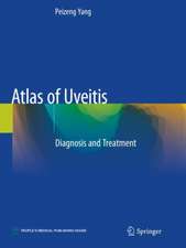 Atlas of Uveitis: Diagnosis and Treatment