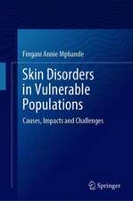 Skin Disorders in Vulnerable Populations: Causes, Impacts and Challenges