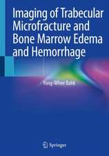 Imaging of Trabecular Microfracture and Bone Marrow Edema and Hemorrhage