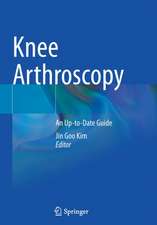 Knee Arthroscopy