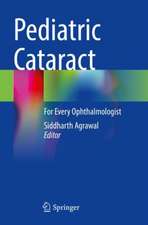 Pediatric Cataract: For Every Ophthalmologist