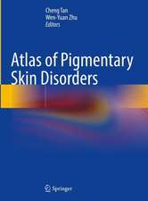 Atlas of Pigmentary Skin Disorders