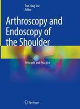 Arthroscopy and Endoscopy of the Shoulder: Principle and Practice