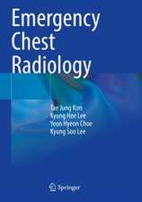 Emergency Chest Radiology