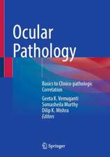Ocular Pathology