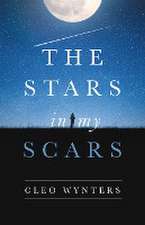 The Stars in My Scars