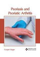 Psoriasis and Psoriatic Arthritis